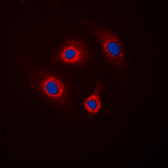 Anti-DARPP-32 (phospho Thr34) antibody used in Immunocytochemistry/ Immunofluorescence (ICC/IF). GTX55025