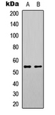 Anti-SGK1 (phospho Ser78) antibody used in Western Blot (WB). GTX55032