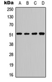 Anti-ATF2 (phospho Ser62) antibody used in Western Blot (WB). GTX55045