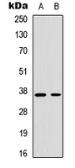 Anti-Cyclin H (phospho Thr315) antibody used in Western Blot (WB). GTX55052