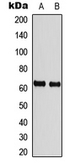 Anti-Chk2 (phospho Thr68) antibody used in Western Blot (WB). GTX55055