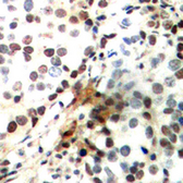 Anti-CREB (phospho Ser142) antibody used in IHC (Paraffin sections) (IHC-P). GTX55056