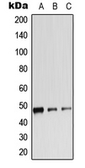 Anti-beta 2 Adrenergic Receptor (phospho Ser346) antibody used in Western Blot (WB). GTX55073