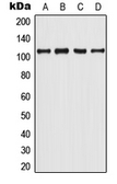 Anti-Androgen Receptor (phospho Tyr363) antibody used in Western Blot (WB). GTX55077