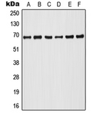 Anti-A-RAF (phospho Tyr302) antibody used in Western Blot (WB). GTX55078