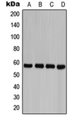 Anti-Caspase 8 (phospho Tyr380) antibody used in Western Blot (WB). GTX55081