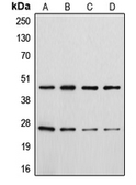 Anti-CD28 (phospho Tyr218) antibody used in Western Blot (WB). GTX55086