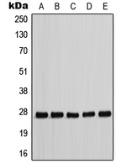 Anti-p27 Kip1 (phospho Thr198) antibody used in Western Blot (WB). GTX55090