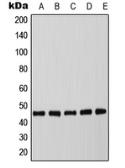 Anti-C/EBP alpha (phospho Thr226) antibody used in Western Blot (WB). GTX55091