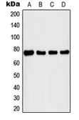 Anti-IRAK1 (phospho Thr209) antibody used in Western Blot (WB). GTX55098