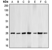 Anti-Bcl-2 (phospho Thr69) antibody used in Western Blot (WB). GTX55105