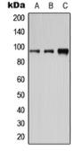 Anti-CD19 (phospho Tyr531) antibody used in Western Blot (WB). GTX55107