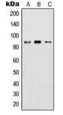Anti-IKK beta (phospho Tyr199) antibody used in Western Blot (WB). GTX55109