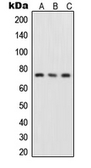 Anti-NFkB p65 (phospho Ser276) antibody used in Western Blot (WB). GTX55113