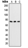 Anti-NFkB p65 (phospho Ser536) antibody used in Western Blot (WB). GTX55114