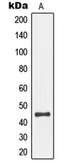 Anti-SEK1 / MKK4 (phospho Ser80) antibody used in Western Blot (WB). GTX55115