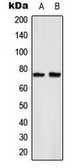 Anti-NFkB p65 (phospho Ser529) antibody used in Western Blot (WB). GTX55127