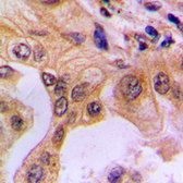 Anti-NFkB p65 (phospho Ser529) antibody used in IHC (Paraffin sections) (IHC-P). GTX55128
