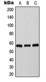 Anti-Tyrosine Hydroxylase (phospho Ser40) antibody used in Western Blot (WB). GTX55129
