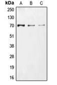 Anti-CDC25A (phospho Ser76) antibody used in Western Blot (WB). GTX55131