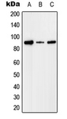 Anti-Factor I antibody used in Western Blot (WB). GTX55153
