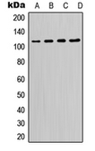 Anti-PI3 kinase p110 delta antibody used in Western Blot (WB). GTX55163