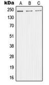 Anti-MED1 antibody used in Western Blot (WB). GTX55164