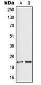Anti-Secretogranin V antibody used in Western Blot (WB). GTX55171