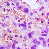 Anti-TSG6 antibody used in IHC (Paraffin sections) (IHC-P). GTX55175
