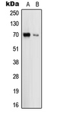 Anti-Uromucoid antibody used in Western Blot (WB). GTX55176