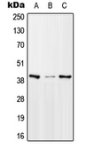 Anti-MTERF antibody used in Western Blot (WB). GTX55178