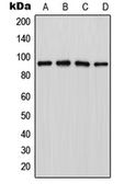 Anti-LZTR1 antibody used in Western Blot (WB). GTX55179