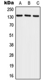 Anti-RECQL4 antibody used in Western Blot (WB). GTX55183