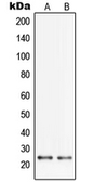 Anti-PGRMC2 antibody used in Western Blot (WB). GTX55189