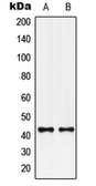 Anti-GPCR G2A antibody used in Western Blot (WB). GTX55201