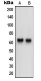 Anti-Neurotrimin antibody used in Western Blot (WB). GTX55202