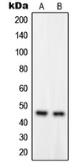 Anti-GPRC5B antibody used in Western Blot (WB). GTX55203