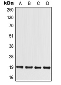 Anti-MED30 antibody used in Western Blot (WB). GTX55209