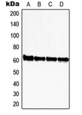 Anti-SUHW1 antibody used in Western Blot (WB). GTX55211