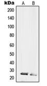 Anti-RPL10L antibody used in Western Blot (WB). GTX55213