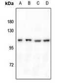 Anti-GPR110 antibody used in Western Blot (WB). GTX55215