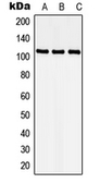 Anti-CDKL5 antibody used in Western Blot (WB). GTX55218