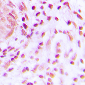 Anti-BARD1 antibody used in IHC (Paraffin sections) (IHC-P). GTX55221