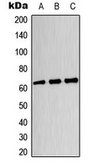 Anti-CRMP3 antibody used in Western Blot (WB). GTX55228