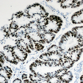 Anti-HBP1 antibody used in IHC (Paraffin sections) (IHC-P). GTX55229