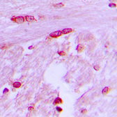 Anti-BTF3L4 antibody used in IHC (Paraffin sections) (IHC-P). GTX55234