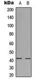 Anti-GPR85 antibody used in Western Blot (WB). GTX55244