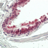 Anti-ZNF496 antibody used in IHC (Paraffin sections) (IHC-P). GTX55254