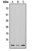 Anti-Osteocalcin antibody used in Western Blot (WB). GTX55255