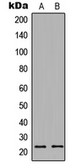 Anti-PTTG1IP antibody used in Western Blot (WB). GTX55274